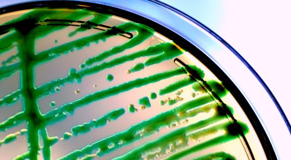 Groene algen in petrischaaltje